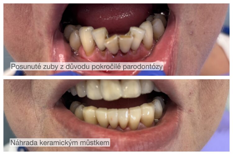 fotka keramického můstku